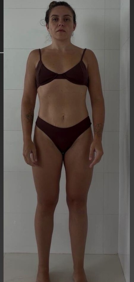 Depois: Antes e depois do tratamento