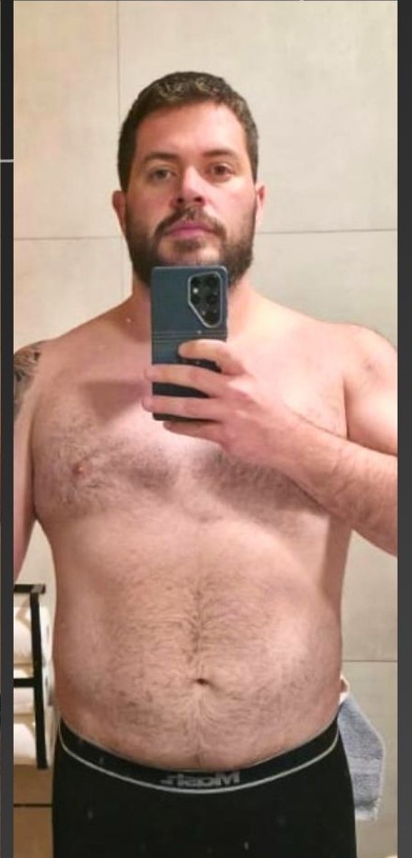 Depois: Resultado do método personalizado
