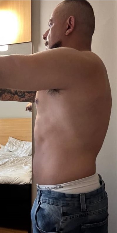Depois: Transformação emagrecimento feminino