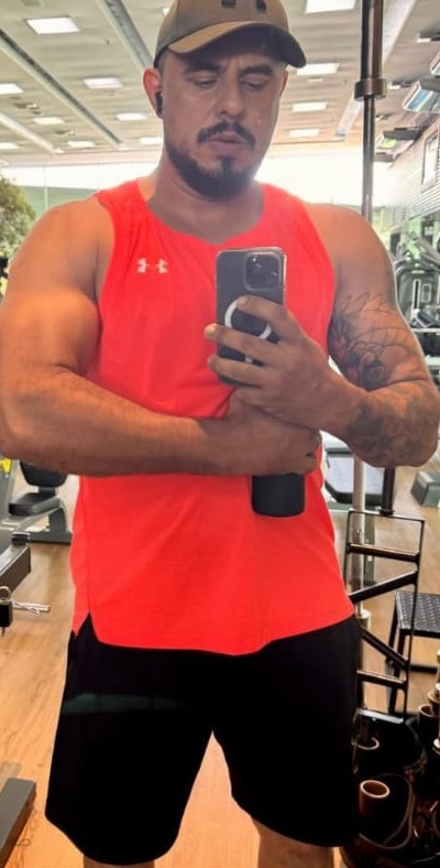 Depois: Resultado tratamento hormonal